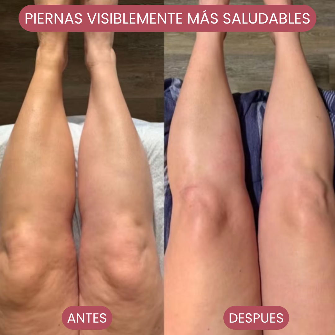 Kit Body Light: Ventosa Térmica + Crema Lipo Reductora