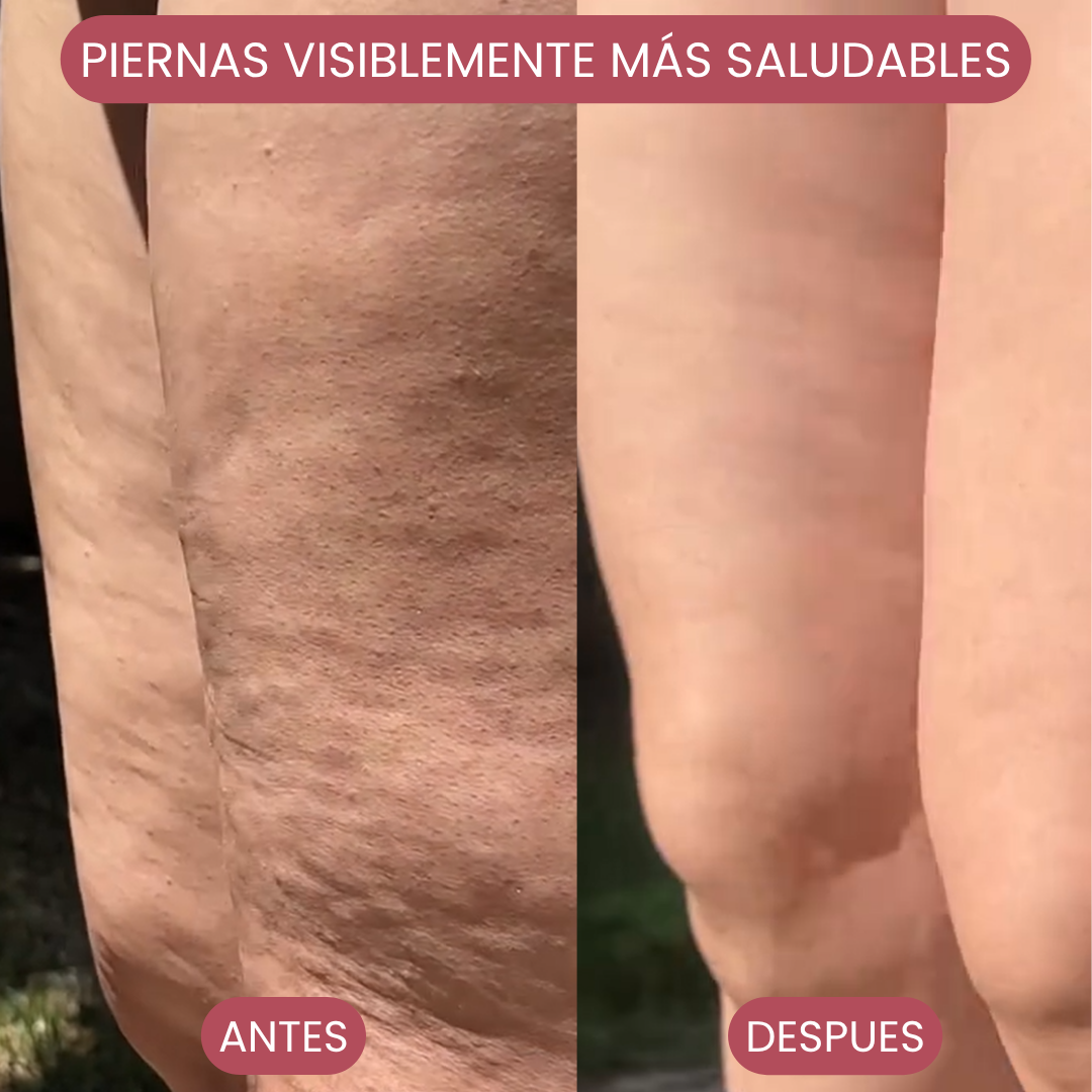 Kit Body Light: Ventosa Térmica + Crema Lipo Reductora