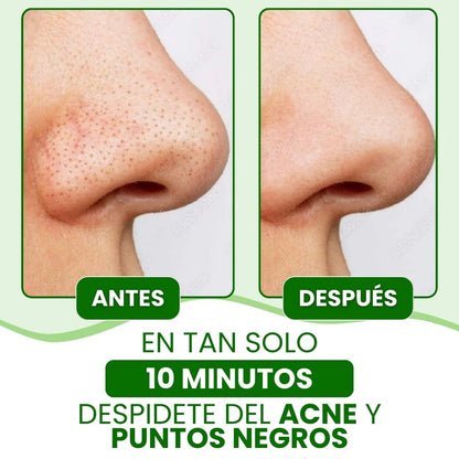 Lanbena® - Mascarilla avanzada para puntos negros
